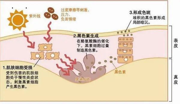 脸上斑点很多祛斑最有效的办法,皮肤不好有斑怎么祛斑