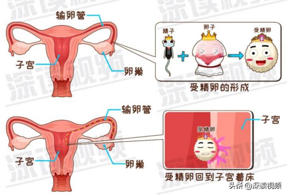 宫外孕出血量和月经一样怎么回事,宫外孕是怎么回事能不能再生孩子