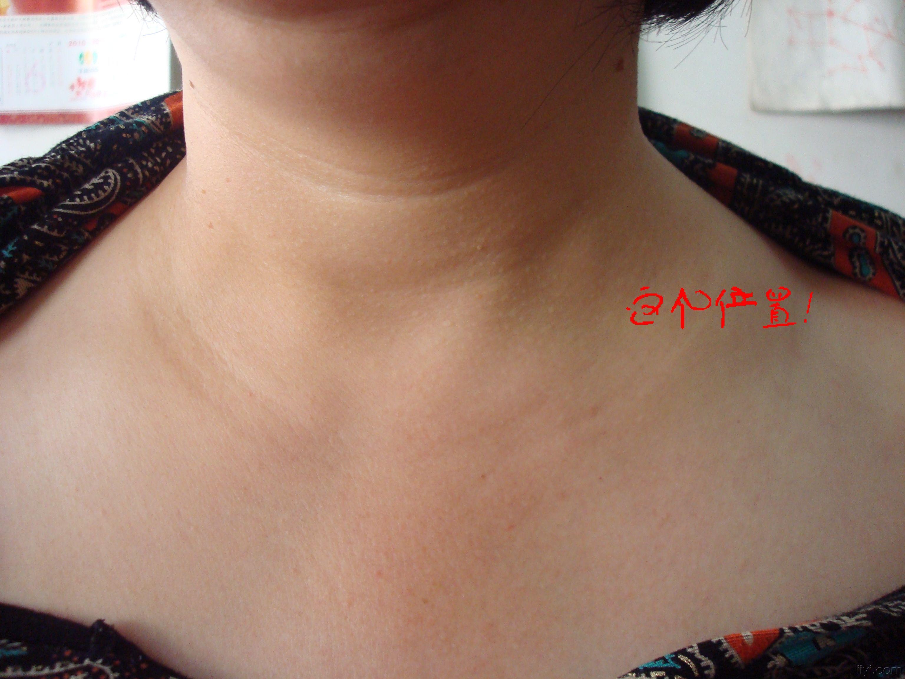 胃病严重了是啥后果,严重胃病会有哪些症状