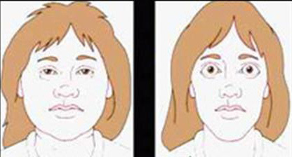 小孩睁眼睡觉是怎么回事,睁眼睡着了是什么原因