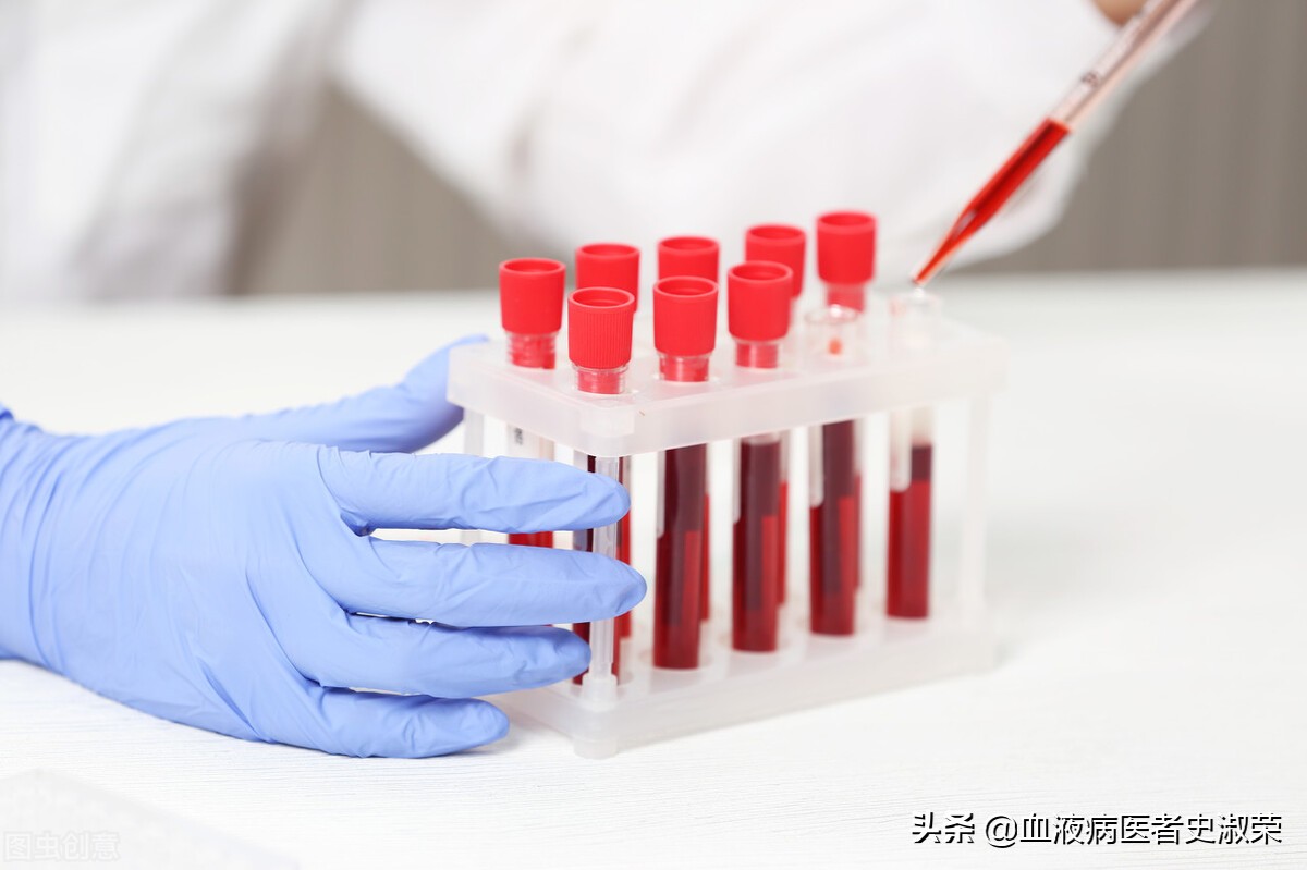 这4个征兆说明血液病治愈了,血液病早期有什么征兆