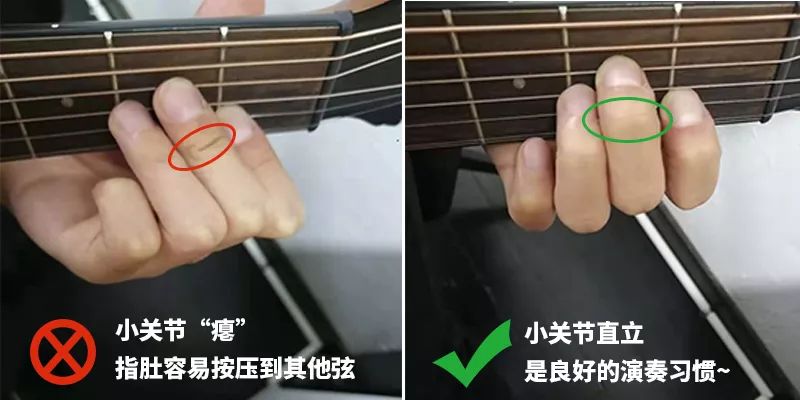 左手僵硬无力是怎么回事,左手伸不直有什么好办法吗