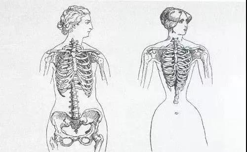 戴束腰子宫下垂,网红束腰导致内脏下垂
