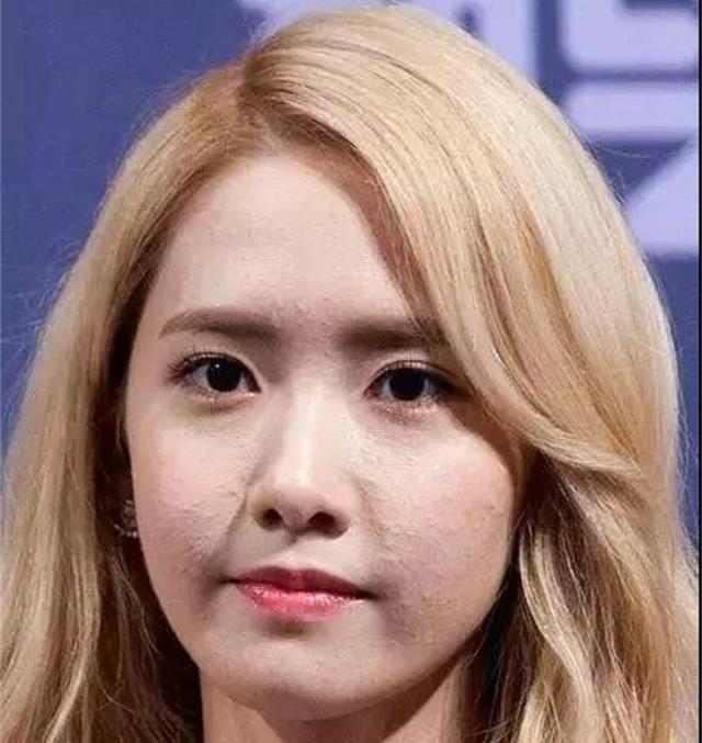 顽固多年黑头闭口毛孔粗大怎么办,南京皮肤病研究所顽固闭口粉刺