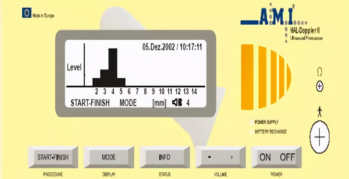 痔疮手术当天去医院就能做吗,两天后能出院的痔疮手术