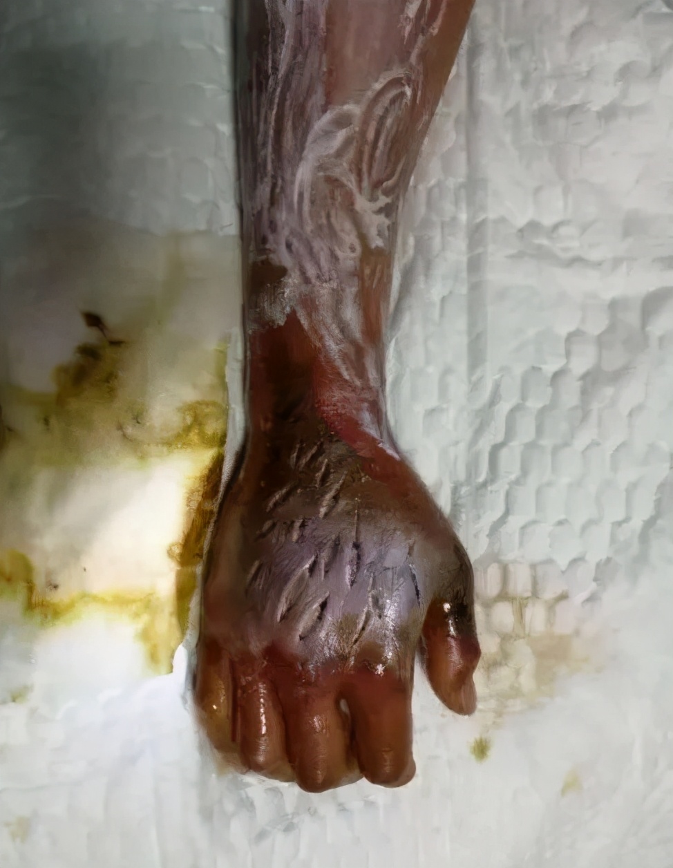 0.08毫克能让人致死，知道我国最毒的蛇有多毒吗？咬后几乎没痛感