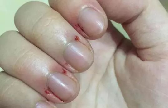 妮娜泰勒是谁,妮娜泰勒的手