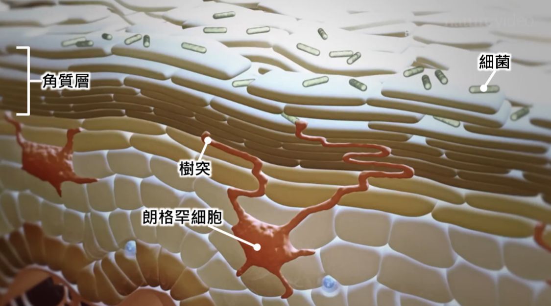 哪里皮肤是角质哪种情况该去角质去角质的方法