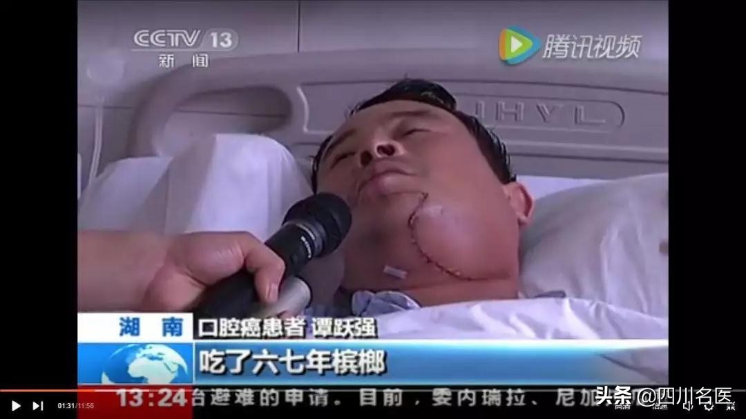 口腔溃疡超过2个月就是口腔癌,口腔溃疡变成唇炎