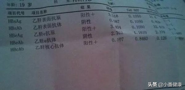 乙肝大三阳症状肝区疼痛,乙肝大三阳转变肝硬化的症状