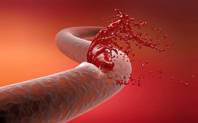 过敏性紫癜还有皮疹可以出院吗,过敏性紫癜皮疹下去多久能上学