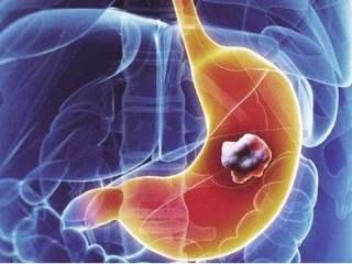 老感觉“菊花”痒,忍不住用手去抠?十有八九是这3种原因