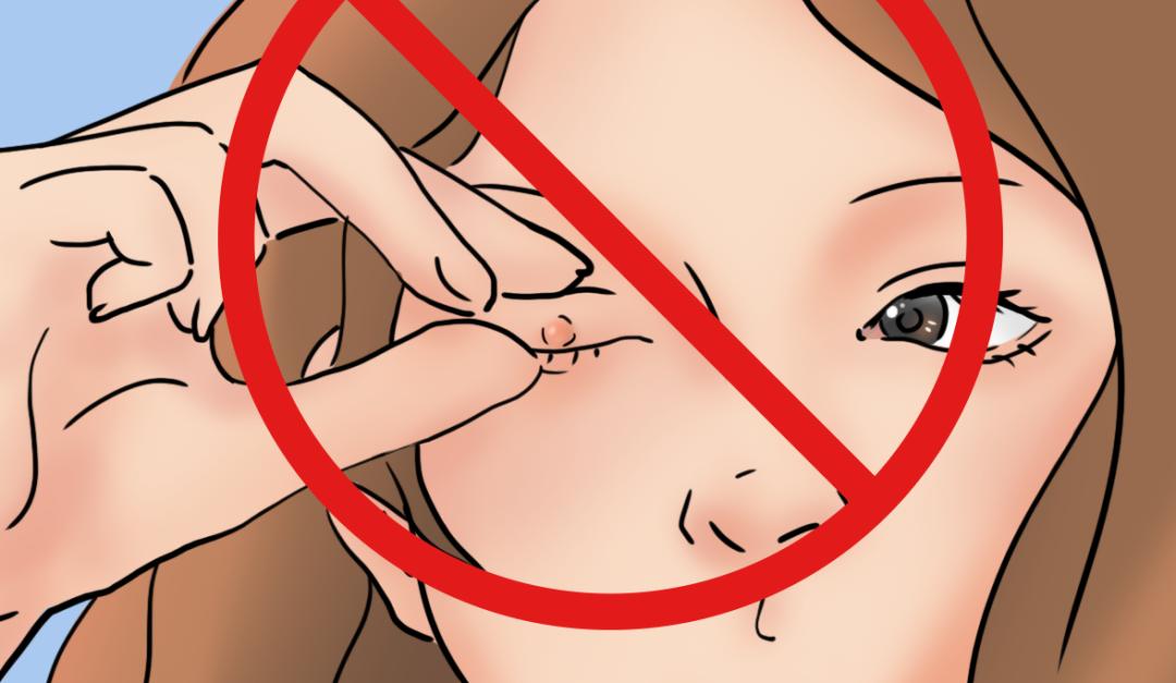 宝宝眼睛长了个麦粒肿,帮孩子规避风险是好是坏