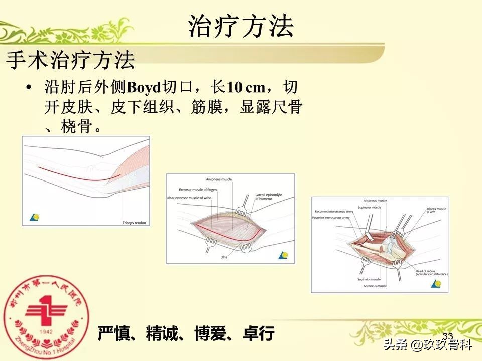 孟氏骨折功能训练多久能恢复正常,孟氏骨折中医能治吗