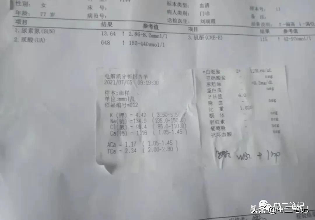 中医治疗母亲肾衰竭,母亲得了肾衰竭怎样治疗