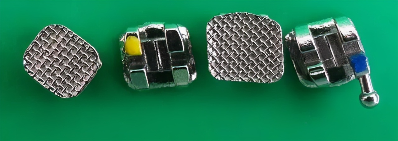 小心翼翼的我，还是把托槽弄掉了