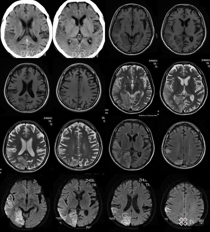 iseihealth:日本高精度的“3个PSA测定”前列腺癌检测纳入保险