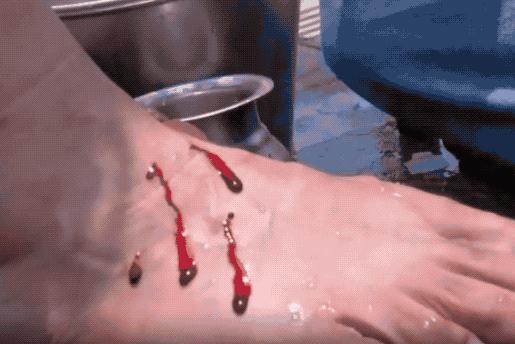 鍙や唬鍖诲鎵嬫湳,涓浗鍙や唬鍖诲鎵嬫湳