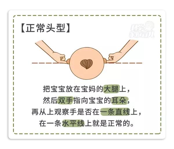 宝宝头睡偏了可以理哪种发型,头睡偏了怎么矫正儿童头型