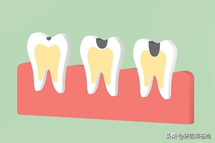 小孩蛀牙疼快速止疼法,蛀牙疼怎么判断是发炎还是神经疼