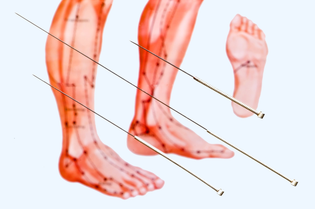 中医治疗癫痫病的第一人,中医治疗癫痫病排名