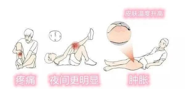 孩子胯骨处长了一个硬疙瘩,小孩胯部肉里长疙瘩怎么回事