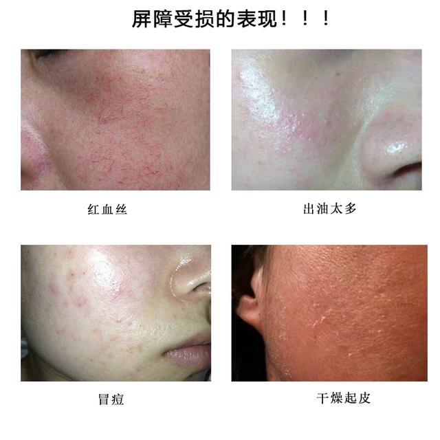 倩碧好物推荐,倩碧真的好吗