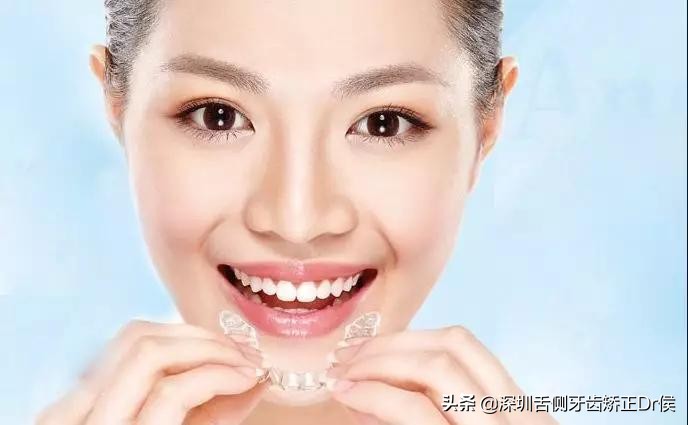 30岁以后还能牙齿矫正吗,30多岁还能牙齿矫正吗