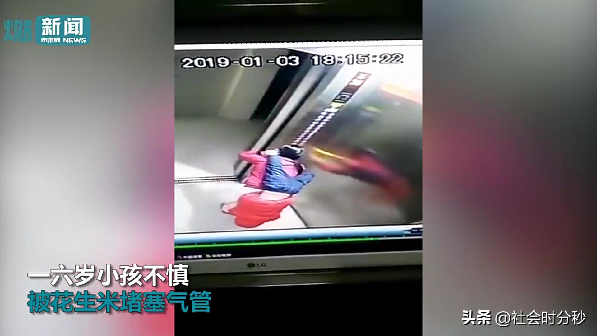 痛心！6岁小孩吃花生窒息而亡每个家长都要学会海姆立克急救法