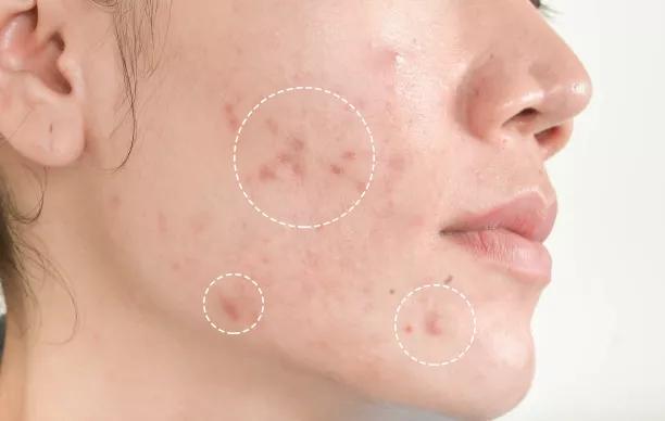 韩国假面膜流入中国,揭秘韩国进口面膜