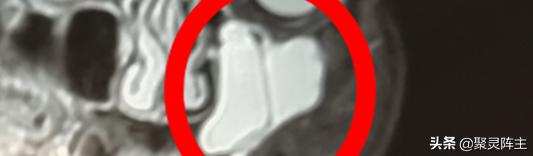 无雾加湿器是智商税吗,加湿器是智商税吗