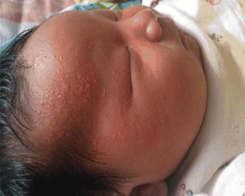 喝奶，辅食添加，防蚊防暑，疾病预防与护理全攻略