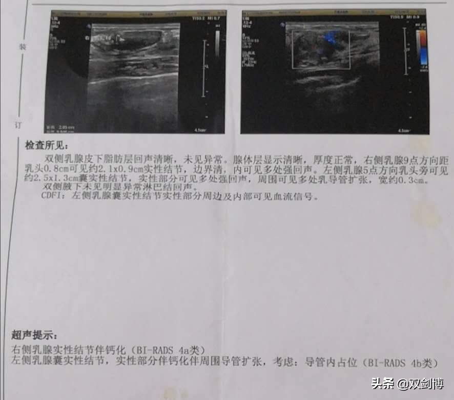 乳房出血是什么原因中年人,乳腺癌晚期乳房出血水怎么解决