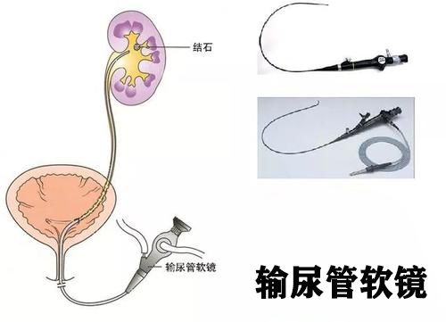 泌尿外科都是男的吗,泌尿外科都是些什么病人