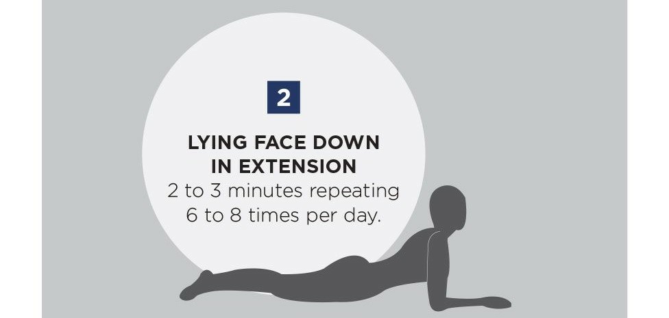 mckenzie运动,mckenzie治疗腰椎间盘突出