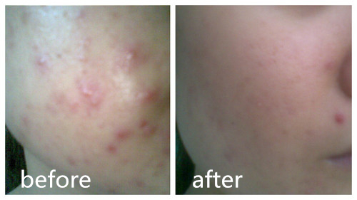 卸妆不彻底肤色不均,卸妆不彻底的后果