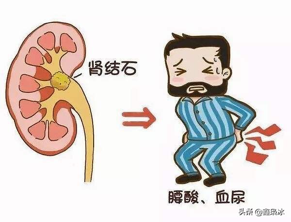 “活人还能让尿给憋死”？我的亲身经历告诉你