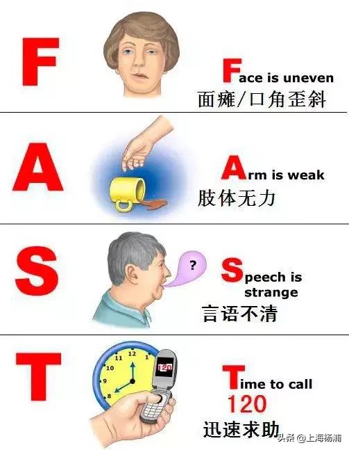 与时间赛跑拯救生命,脑卒中赛跑