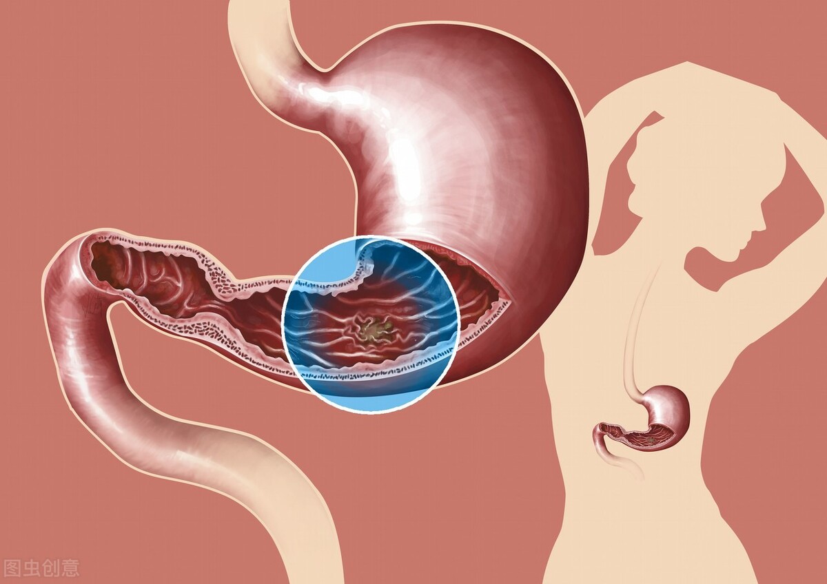 无痛胃镜和胶囊胃镜哪个比较好,胃镜检查是无痛胃镜还是普通的好