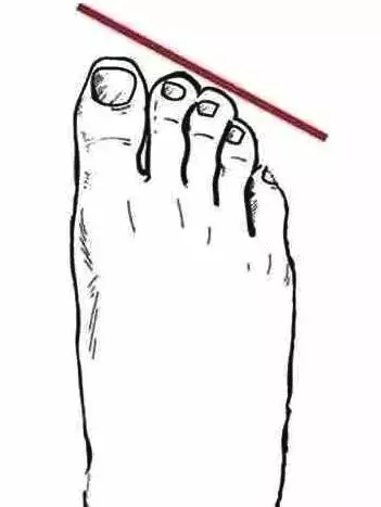 你的脚是正常脚型吗,你的脚型属于哪种呢