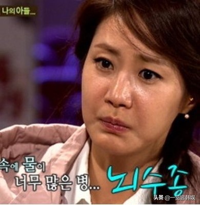 47岁申恩庆图片,47岁申恩庆削骨现状