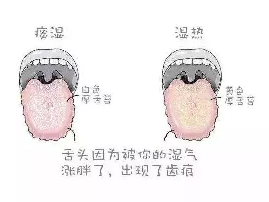 妇科炎症吃什么中药调理,妇科炎症口服什么药可以治愈