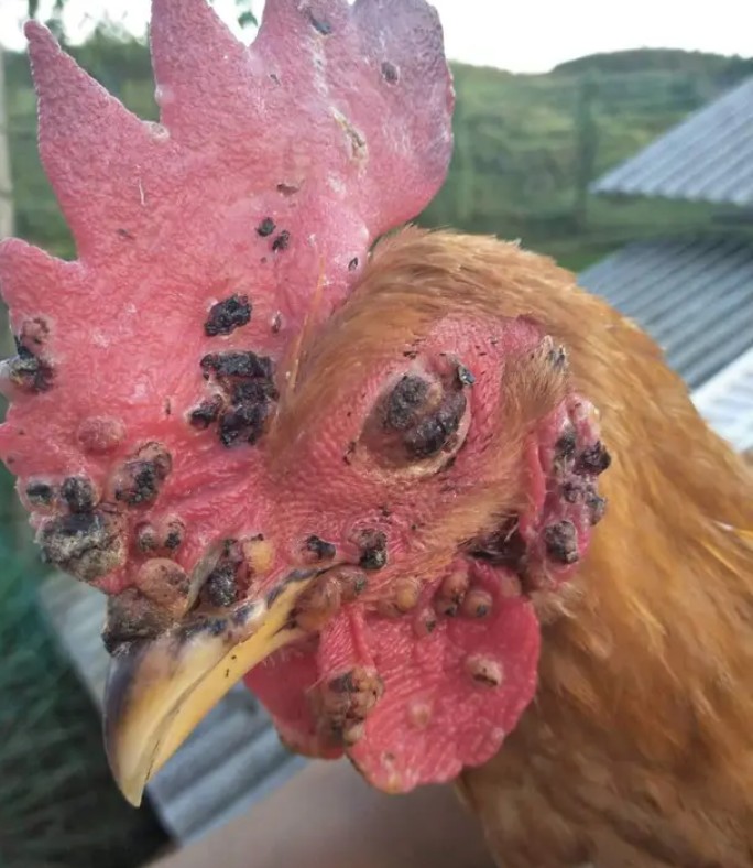 鸡眼睛长痘的最快治疗方法,人手上长鸡痘怎么治疗