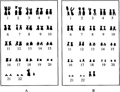 火化后的骨灰能检测dna吗,火化后骨灰能做dna检查吗