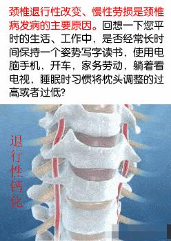 六步颈椎操解决99%的常见颈椎问题,我用13节颈椎操缓解几万人的颈椎