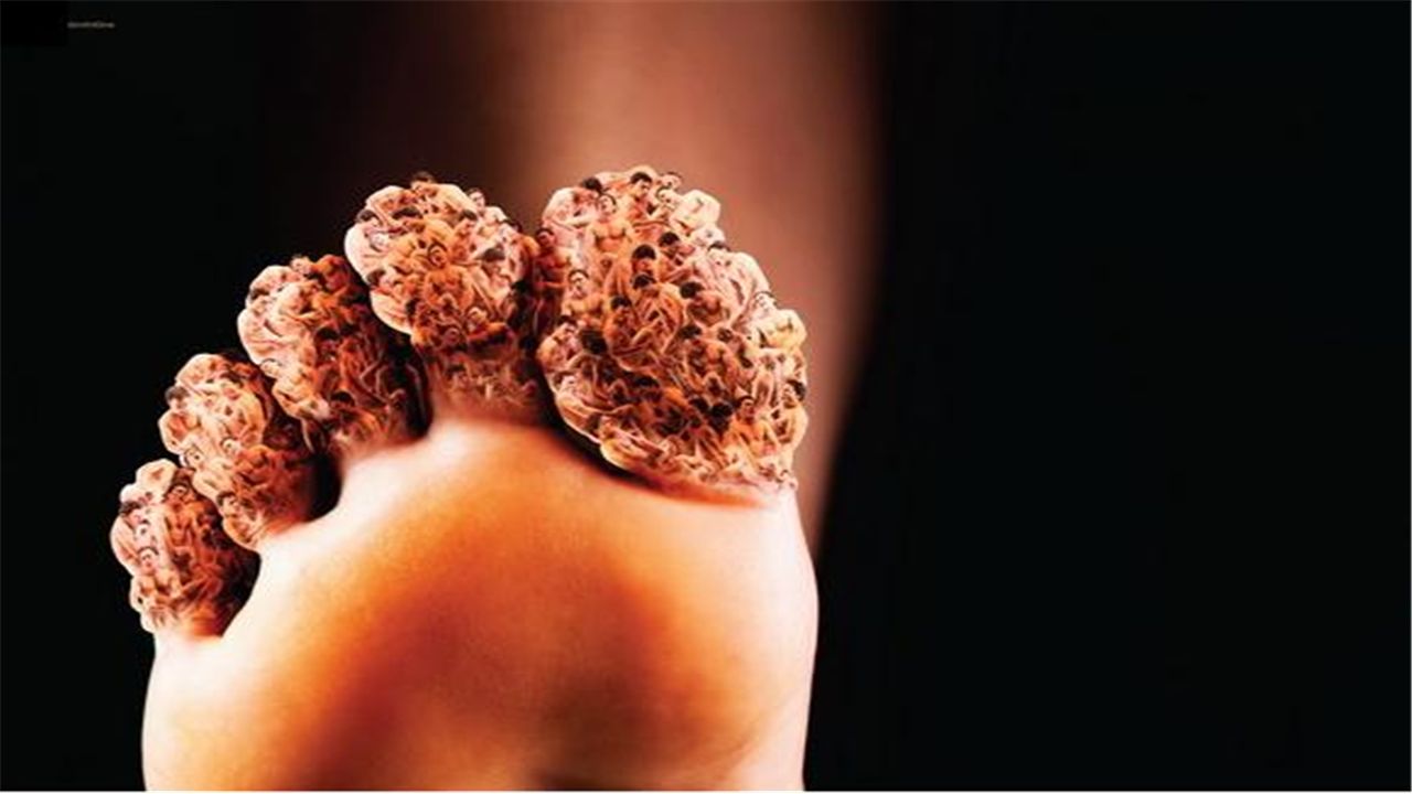 乌鸡白凤丸对痛风病人有什么好处,六味地黄丸和乌鸡白凤丸治痛风吗