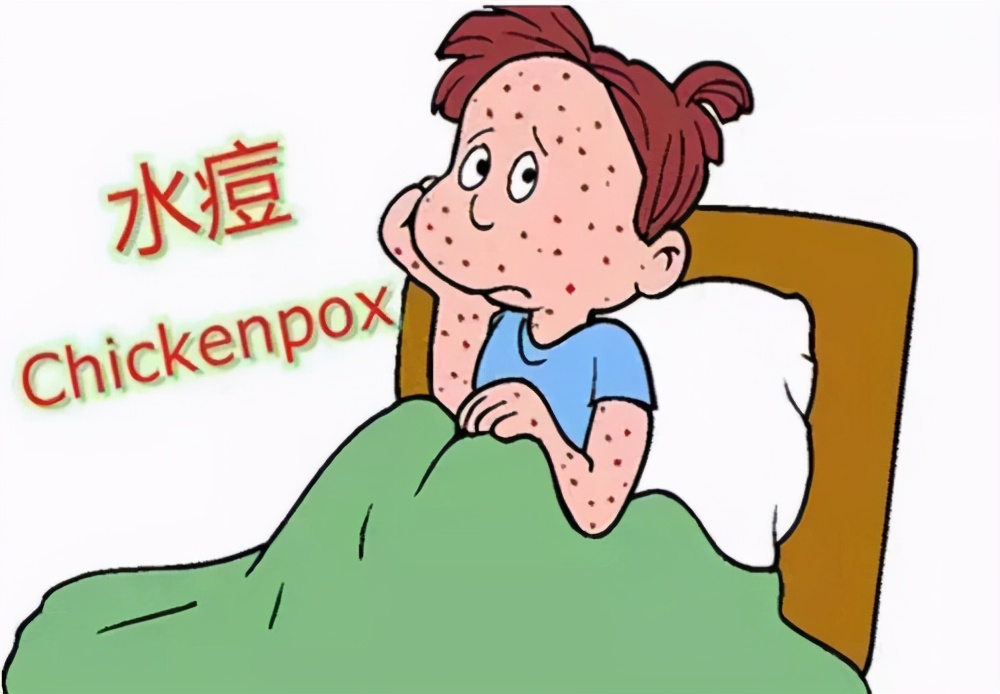 一颗水痘的独白|又是一年战“痘”季,快来看看对手什么样