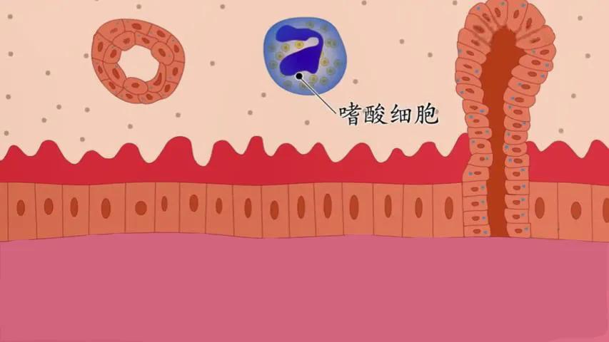 老鼻炎怎么治,老人长期鼻炎需要注意什么