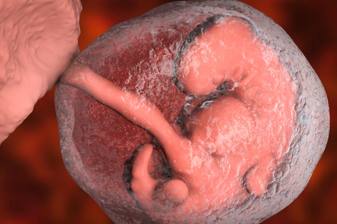 羊水为啥那么重要,羊水和羊胎膜是一个东西吗