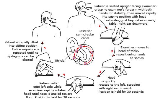 一翻身就眩晕看什么科,往左翻身头晕是哪个耳石症